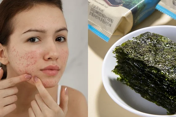 Rong Biển Ăn Liền Có Nóng Không? Giải Mã Sự Thật Và...