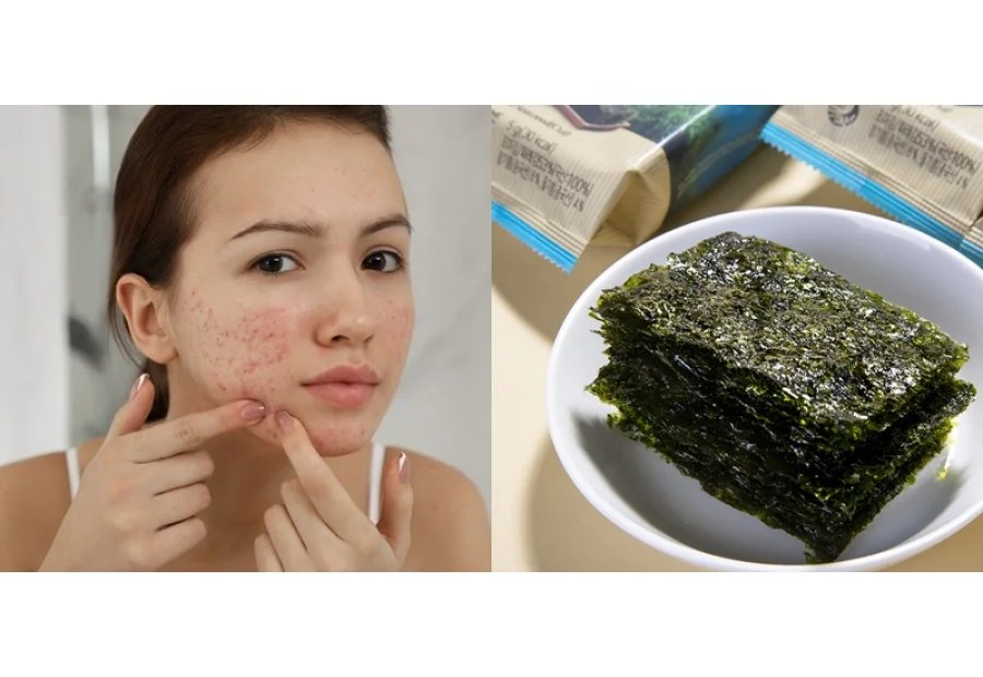 Rong Biển Ăn Liền Có Nóng Không? Giải Mã Sự Thật Và...